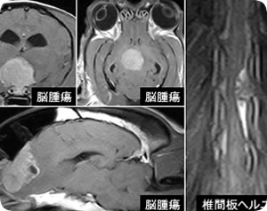 MRI撮影画像